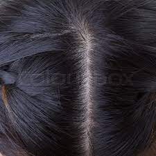 Black people's does not have black dandruff because dandruff is a sign of different medical conditions. Black Hair With Dandruff On Head Stock Image Colourbox
