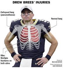 Ribs are attached to the breastbone that runs down the center of the chest. Drew Brees Injury Overview Collapsed Lung Fractured Ribs And A Look At The Recovery Time Saints Nola Com