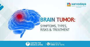 There are some symptoms that many people may not associate with a tumor in the brain. Brain Tumor Symptoms Types Risk Treatment