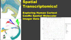 Spatial Transcriptomics - Part 2: Exploring Seurat Object - YouTube