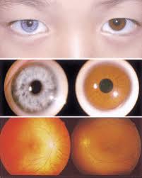 Terdapat banyak pilihan penyedia file pada. Top External Photograph Of A 9 Year Old Brother Of The Proband With Download Scientific Diagram