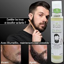 Huile prodigieuse nuxe pour le visage sèche, corps et cheveux 50 ml ou 100 ml. Huile De Ricin Cosmetique Naturelle Barbe Et Cheveux Hommes Beard Growth Care Oil 100 Ml Details Et Prix Au Maroc Vendo Ma