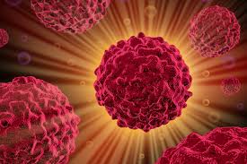As there is such a vast amount of different cancers out there, diagnosis can sometimes be mistaken. Copd And Lung Cancer Greater Patient Awareness Needed Rt