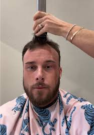 Malachi Reyes Receding Hair Line Buzz