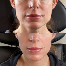 Katie Estes in Monterey, CA