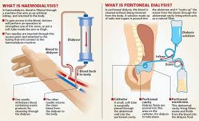 Image Result For Peritoneal Dialysis Nursing Peritoneal