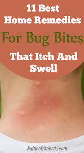 5.) heat treatment for bed bug bites (home treatment). Pin On Bug Bites And Remedies