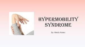 Image result for Hypermobility Signs