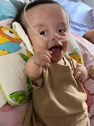 What are the experiences of parents with children having Thanatophoric  Dysplasia type 1?