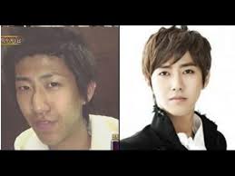Korean Actor Plastic Surgery Korean Celebrity Male And Female Before And After Plastic Surgery Plastic Surgery Celebrity Plastic Surgery Celebs Without Makeup
