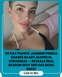 Jasmine Pineda's Real Reason for Going Bald Revealed