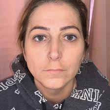 TrueBrow™ International