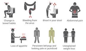 It occurs both in men and in women. Colorectal Cancer Causes Symptoms Screening Treatment Health Plus