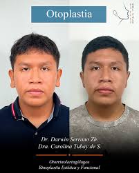 Dr. Darwin Serrano Zhune (@dr.darwinserrano) · Salinas