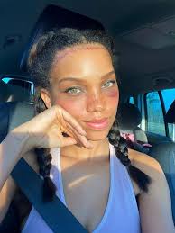 Mum spends £5,000 getting her forehead shortened after hiding behind fringe  for 10 years