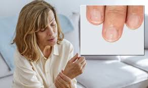 Si vous avez remarqué une ou plusieurs taches blanches sur vos ongles vous vous êtes peut être posé des. C12u Wdjtowo7m
