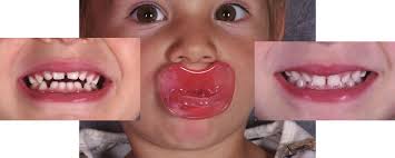 The MARA Appliance T