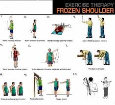 Exercises For Frozen Shoulder Frozen Shoulder Frozen