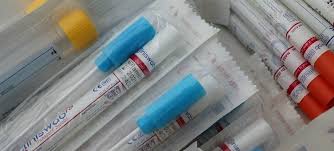 Le test de dépistage pour le coronavirus est basé sur une méthode de biologie moléculaire appelée pcr (polymerase chain reaction ou réaction en chaîne par polymérase).c'est une technique. Quando Deve Ser Feito O Pcr Rt Para Coronavirus