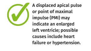 Image result for Point of Maximum Impulse