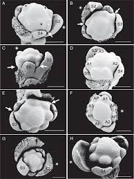 Whether it's a gift for your wife on her birthday, or a bouquet of flowers for your mum to tell her just how much you miss all of our flower gifts to upper east side can arrive at their destination on the same day owing to our commitment towards expedited gift delivery. Floral Development And Anatomy Of Macarthuria Australis Macarthuriaceae Key To Understanding The Unusual Initiation Sequence Of Caryophyllales