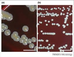 Colonies are golden and strongly hemolytic on blood agar. Figure 1 From Staphylococcus Aureus As An Intracellular Pathogen The Role Of Small Colony Variants Semantic Scholar