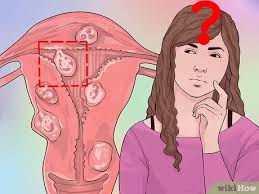 For women aged 35 to 54, the most common reasons for. 4 Ways To Decide If You Need A Hysterectomy Wikihow