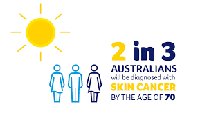 Sun protection is required when the uv levels reach 3 and above. Preventing Skin Cancer Cancer Council Nsw
