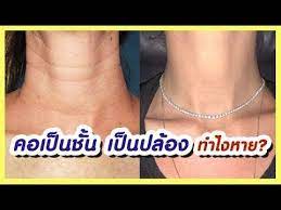 คอเป นช น คอเป นปล อง รอยพ บ ทำไงหาย ม ทางแก ว ธ ธรรมชาต ค ดส ตรท ได ผล get rid of neck lines youtube ความงาม ฟ ตร างกาย สวย