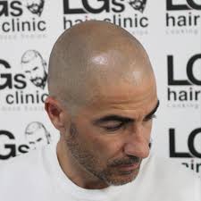 LGS Hair Clinic España added a...