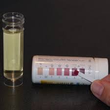 11 Detailed Ketone Test Strip Color Meaning