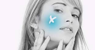 Image result for phlegmon on face)