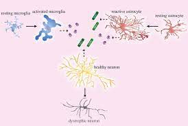 The Role Of Astrocytes In Amyloid Production And Alzheimer S Disease Open Biology