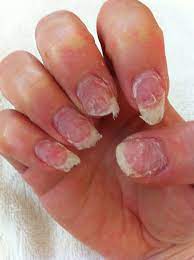 Uspedicurechaira Can I Harm My Natural Nails By Wearing Acrylic Nails