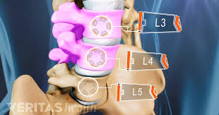 Lumbar Spondylolisthesis Icd 10