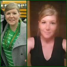 Hypothyroid In Photos Before And After Stop The Thyroid Madness