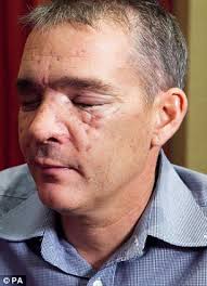 The prime minister pays tribute to the policeman shot and blinded by raoul moat, after he was found dead at his home. Raoul Moat Said Pc David Rathband Looked A Mess After Shooting Him In The Face Daily Mail Online