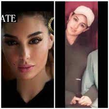 أول ما يجب أخذه بعين الإعتبار أن هذه العملية الجراحية قد تستغرق يومًا بأكمله. Ù‡ÙƒØ°Ø§ ÙƒØ§Ù†Øª ÙŠØ§Ø³Ù…ÙŠÙ† ØµØ¨Ø±ÙŠ Ù‚Ø¨Ù„ Ø¹Ù…Ù„ÙŠØ§Øª Ø§Ù„ØªØ¬Ù…ÙŠÙ„ Ø¨Ø§Ù„ØµÙˆØ±Ø©