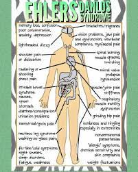 Pin By Rita Alonzo On Health Ehlers Danlos Syndrome Symptoms Ehlers Danlos Syndrome Hypermobility Ehlers Danlos Syndrome