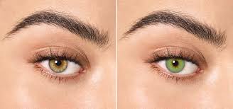 The most beautiful eye colour? Before After Green Eyes
