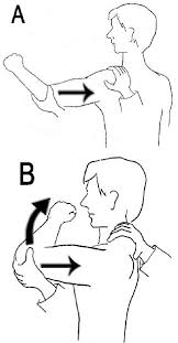 Image result for Shoulder Instability Exam