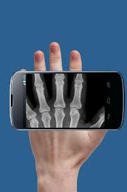You take the photo to the left and see a ray x. Real X Ray Body Scanner Prank X Ray App For Android Apk Download