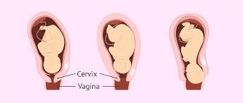 Image result for cervix position