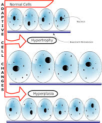Do cells grow in size. Hypertrophy Wikipedia