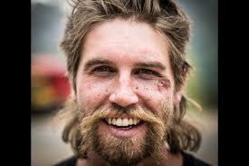 Fundraiser for Logan James by Grady James : Logan James Double Knee Surgery