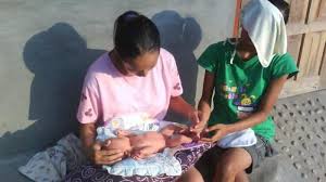 Dari situ bisa diketahui apa permasalahannya dan bagaimana. Beginilah 5 Cara Menghilangkan Penyakit Kuning Bayi Menyusui Secara Teratur Sriwijaya Post