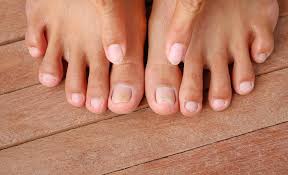 why toenail fungus should never go