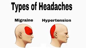 Types Of Headaches Know Your Meme