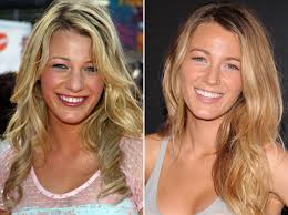 3is jodie sweetin plastic surgery justifiable? Blake Lively Plastic Surgery Nose Job Breast Implants Plastic Surgery Stars