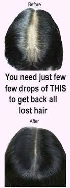 The Below Natural Hair Packs And Oil Will Add Moisture And Shine To Your Hair They Will Nourish The Scalp Helping To Reduc Lost Hair Regrow Lost Hair Hair Oil